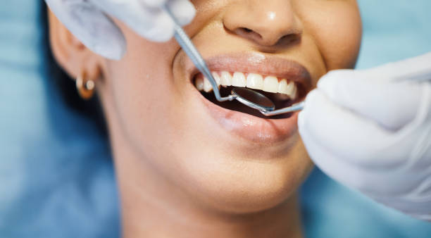 Best Emergency Treatment for Dental Infections or Abscesses in Good Hope, AL